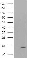 ATP6V1F Antibody in Western Blot (WB)