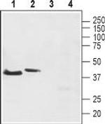 Neurokinin 2 Receptor (NK2R) Antibody in Western Blot (WB)