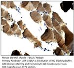 Fbx32 Antibody in Immunohistochemistry (IHC)