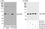 ATRIP Antibody in Western Blot (WB)