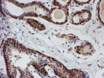 ATRIP Antibody in Immunohistochemistry (Paraffin) (IHC (P))