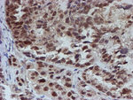 ATRIP Antibody in Immunohistochemistry (Paraffin) (IHC (P))