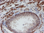 ATRIP Antibody in Immunohistochemistry (Paraffin) (IHC (P))