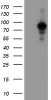 ATRIP Antibody in Western Blot (WB)