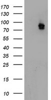 ATRIP Antibody in Western Blot (WB)