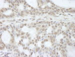 ATRX Antibody in Immunohistochemistry (IHC)