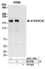 ATX2/SCA2 Antibody in Western Blot (WB)