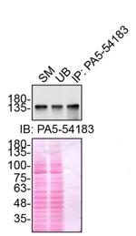 Ataxin 2 Antibody in Immunoprecipitation (IP)