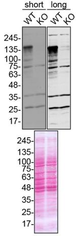 Ataxin 2 Antibody in Western Blot (WB)