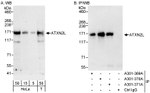 ATXN2L Antibody in Western Blot (WB)