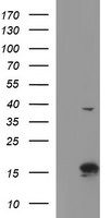 ATXN7L1 Antibody in Western Blot (WB)