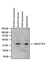 ATXN7L3 Antibody in Western Blot (WB)