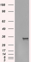 AURKC Antibody in Western Blot (WB)