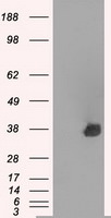 AURKC Antibody in Western Blot (WB)