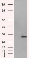 AURKC Antibody in Western Blot (WB)