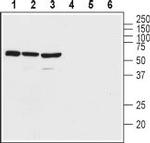 VPAC2 (VIPR2) (extracellular) Antibody in Western Blot (WB)