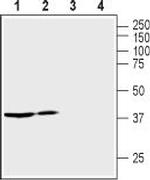 Vasopressin V2 Receptor (AVPR2) Antibody in Western Blot (WB)