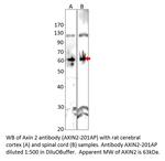 Axin 2 Antibody in Western Blot (WB)