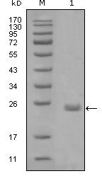 Axl Antibody in Western Blot (WB)