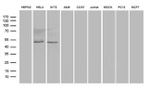 AZIN1 Antibody in Western Blot (WB)