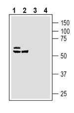 ZIP14 (SLC39A14) Antibody in Western Blot (WB)