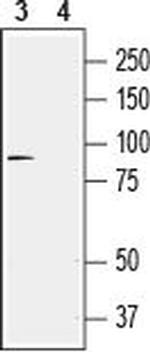 TRPV4 Antibody in Western Blot (WB)