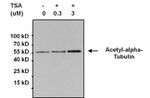 Acetylated Lysine Antibody in Immunoprecipitation (IP)