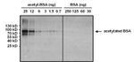 Acetylated Lysine Antibody in Western Blot (WB)