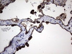 Acidic Cytokeratin Antibody in Immunohistochemistry (Paraffin) (IHC (P))