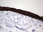 Acidic Cytokeratin Antibody in Immunohistochemistry (Paraffin) (IHC (P))