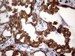 Acidic Cytokeratin Antibody in Immunohistochemistry (Paraffin) (IHC (P))