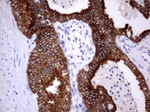 Acidic Cytokeratin Antibody in Immunohistochemistry (Paraffin) (IHC (P))