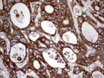 Acidic Cytokeratin Antibody in Immunohistochemistry (Paraffin) (IHC (P))