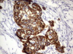 Acidic Cytokeratin Antibody in Immunohistochemistry (Paraffin) (IHC (P))