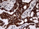 Acidic Cytokeratin Antibody in Immunohistochemistry (Paraffin) (IHC (P))