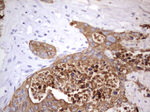 Acidic Cytokeratin Antibody in Immunohistochemistry (Paraffin) (IHC (P))