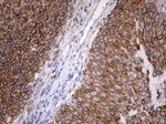 Acidic Cytokeratin Antibody in Immunohistochemistry (Paraffin) (IHC (P))