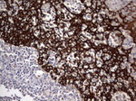 Acidic Cytokeratin Antibody in Immunohistochemistry (Paraffin) (IHC (P))