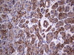 Acidic Cytokeratin Antibody in Immunohistochemistry (Paraffin) (IHC (P))