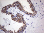 Acidic Cytokeratin Antibody in Immunohistochemistry (Paraffin) (IHC (P))