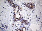 Acidic Cytokeratin Antibody in Immunohistochemistry (Paraffin) (IHC (P))