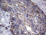 Acidic Cytokeratin Antibody in Immunohistochemistry (Paraffin) (IHC (P))