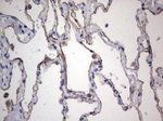 Acidic Cytokeratin Antibody in Immunohistochemistry (Paraffin) (IHC (P))