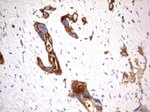 Acidic Cytokeratin Antibody in Immunohistochemistry (Paraffin) (IHC (P))