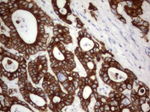 Acidic Cytokeratin Antibody in Immunohistochemistry (Paraffin) (IHC (P))