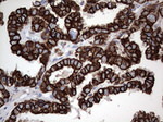 Acidic Cytokeratin Antibody in Immunohistochemistry (Paraffin) (IHC (P))