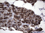 Acidic Cytokeratin Antibody in Immunohistochemistry (Paraffin) (IHC (P))