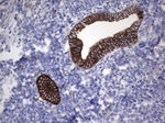 Acidic Cytokeratin Antibody in Immunohistochemistry (Paraffin) (IHC (P))