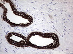 Acidic Cytokeratin Antibody in Immunohistochemistry (Paraffin) (IHC (P))