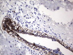 Acidic Cytokeratin Antibody in Immunohistochemistry (Paraffin) (IHC (P))